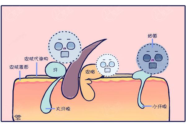 miradry微波治疗腋臭收费标准是多少