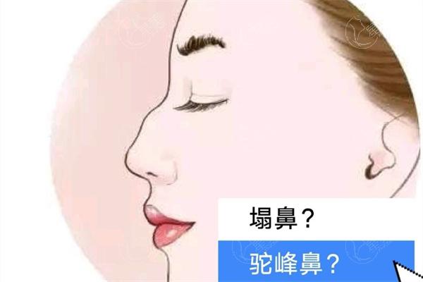 大连十大整形医院排名25版:附大连隆胸/隆鼻拉皮/吸脂手术价格