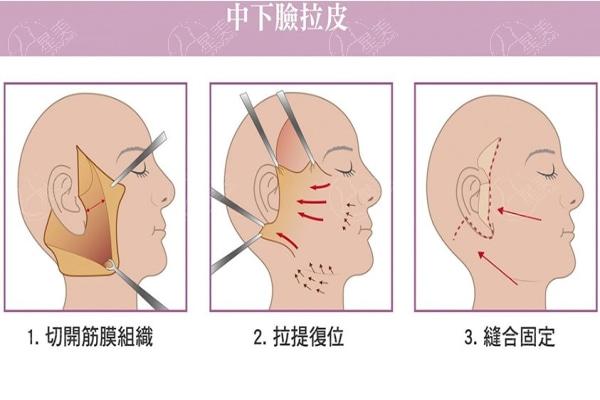 怎样预 约袁强博士医生?分享挂号预 约方式及坐诊医院实力