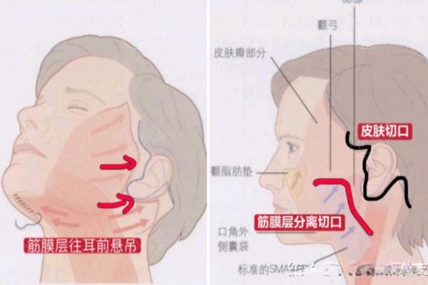 怎样预 约袁强博士医生?分享挂号预 约方式及坐诊医院实力